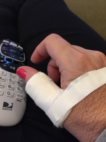 Julie's sabering injuries; more than just an ego bruising.